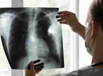 Sensor to Detect Lung Diseases
