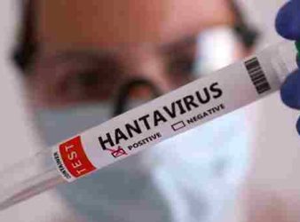 Hantavirus