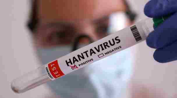 Hantavirus